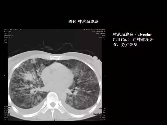 澳门刘伯温四码选一码