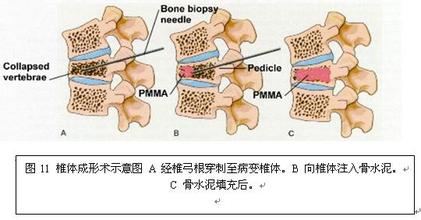 澳门刘伯温四码选一码